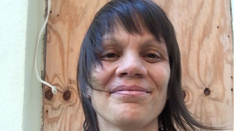 Melanie podjęła decyzję: nie będzie rekonstruować biustu. 