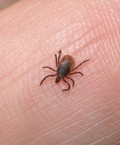 Jak odstraszyć kleszcze? Co zrobić, żeby uchronić się przed kleszczami podczas spacerów