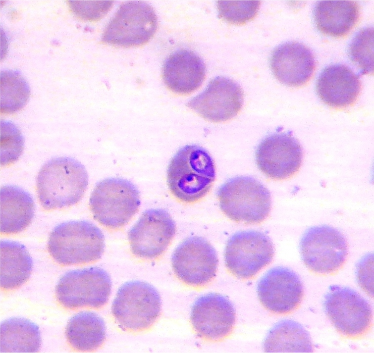Mikroskopowe zdjęcie pierwotniaków z rodzaju Babesia