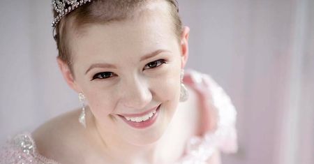 Przez lata była częściowo łysa. Teraz zdobyła tytuł "najpiękniejszej"
