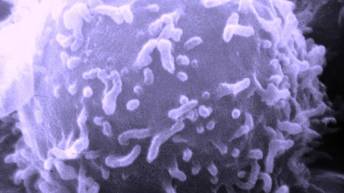 Naukowcy testują nową metodę leczenia raka prostaty