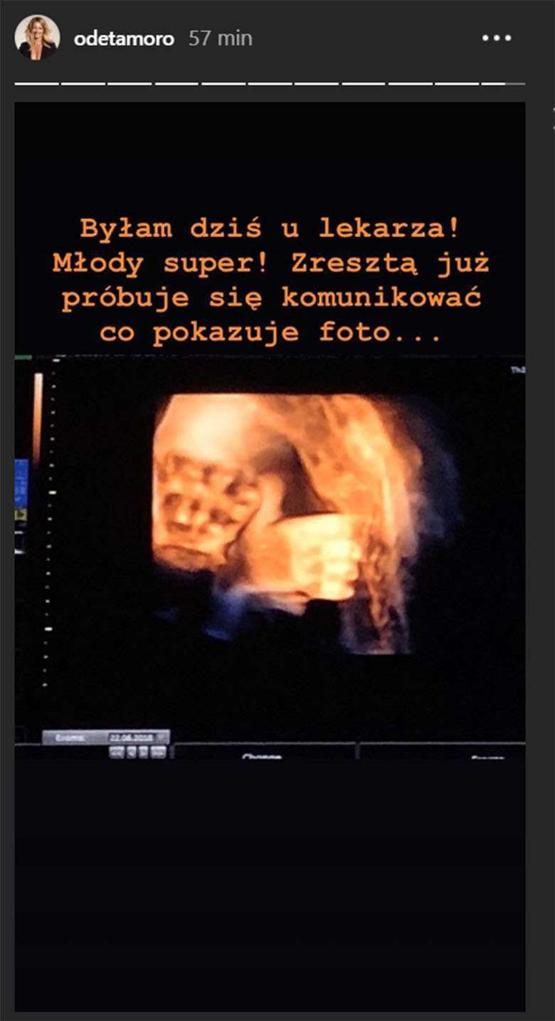 Odeta Moro pokazała zdjęcie synka
