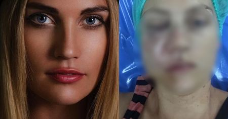 Rosyjską modelkę pobił mąż. Leżała w kałuży krwi