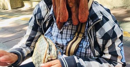 Jej twarz "topi się" w oczach