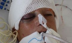 Kobieta w srebrnych butach znaleziona pod Grudziądzem. Policja prosi o pomoc w identyfikacji