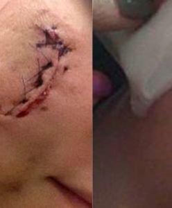 Pocięte "tulipanem" kobiety rozpoznały sprawcę