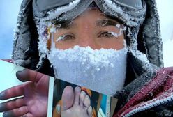 Tak wyglądają stopy i dłonie Elisabeth Revol. Grozi jej amputacja