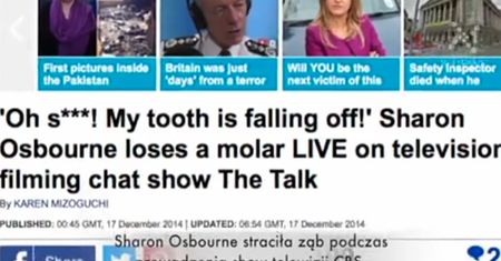 Sharon Osbourne wypadł ząb w programie na żywo