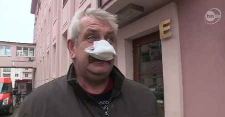Łódź: odgryzł 50-latkowi kawałek nosa