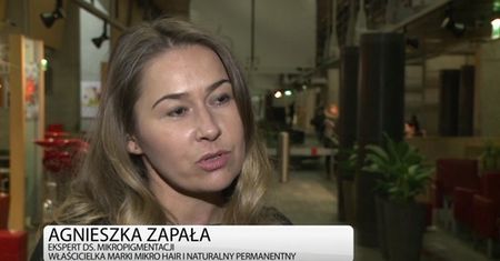 Łysienie to nie tylko problem mężczyzn
