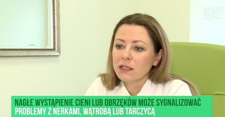 Przyczyny podkrążonych oczu [Specjalista radzi]