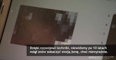 Niewidomy po 10 latach znów zobaczył żonę