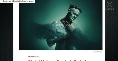 Modelka z chorobą genetyczną podbije świat mody?