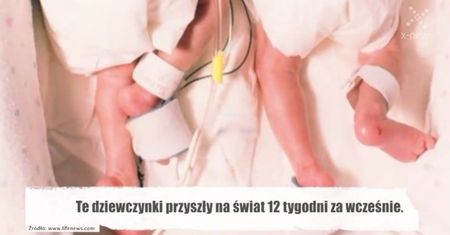 Niezwykłe zdjęcie bliźniaczek