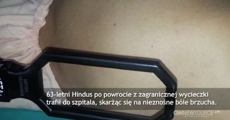 Połknął 12 sztabek złota