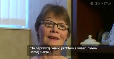 Nietypowa metoda walki z łysieniem