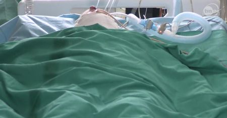Najciężej poparzona ofiara już w Siemianowicach