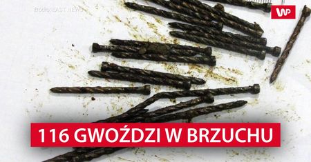 Przyszedł do lekarza z bólem brzucha. Powód był zdumiewający