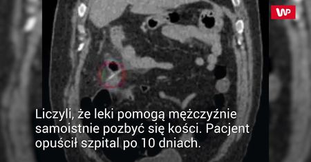 Niechcący połknął kość kurczaka. Do dzisiaj ma awersję