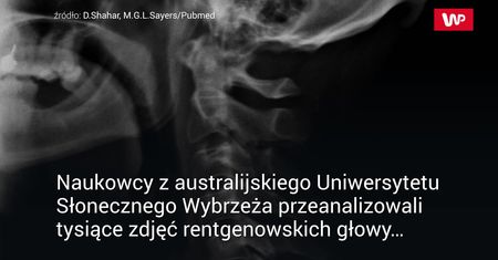 Korzystanie z komórki zmienia nasz szkielet. Najnowsze doniesienia naukowców