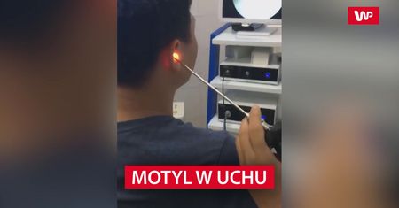 3 dni chodził z owadem w uchu. Lekarz musiał chwycić się za głowę