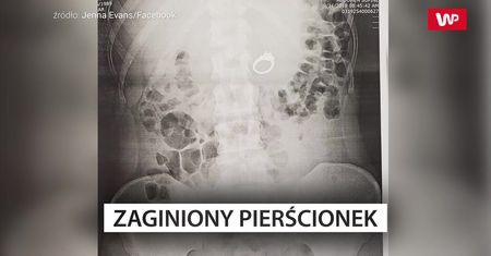 Zaginiony pierścionek. Zaskakujące, gdzie go znaleziono