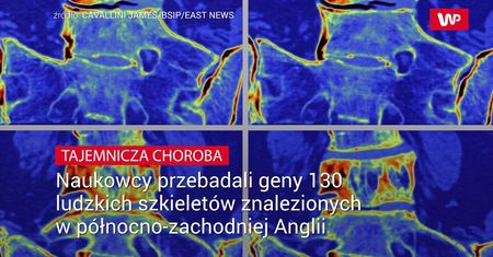 Tajemnicza choroba znaleziona w szkieletach