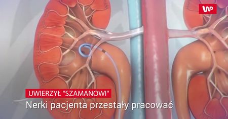 Zawierzył "szamanowi". Skutki będzie odczuwał do końca życia