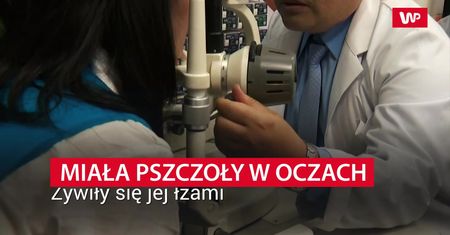 Pszczoły w oczach. Niezwykły przypadek na Tajwanie