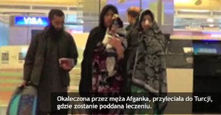 Obciął jej nos, bo wyszła z domu bez jego zgody