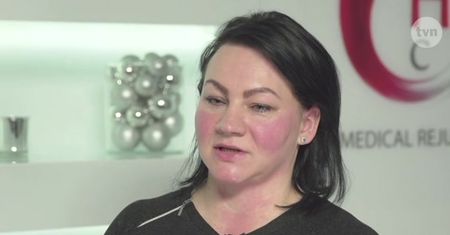 Zabieg fototerapii w "Dzień Dobry TVN": "Policzki pieką, ale uśmiech doktora Gojdzia leczy"