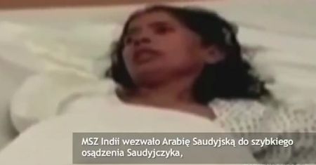 Poskarżyła się na warunki pracy. Ucięto jej ramię