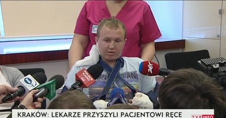 W Krakowie mężczyźnie przyszyto obie dłonie. "Nie traciłem nadziei"
