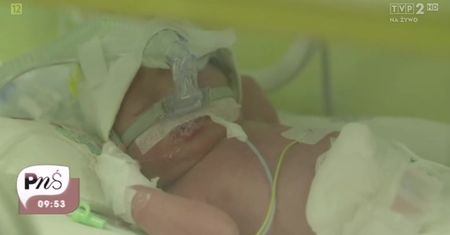 Urodziła bliźniaczki w 33. tygodniu ciąży. Przeżyły dzięki tym lekarzom