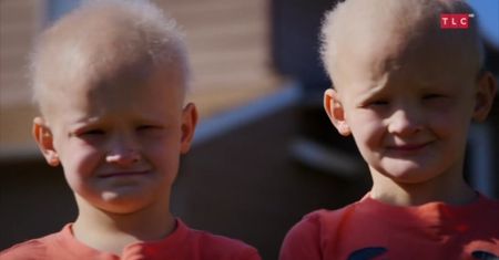Dysplazja ektodermalna [Odnaleźć się w chorobie]