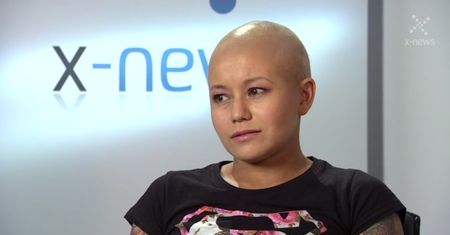 Trenerka fitness cierpiąca na chorobę autoagresywną: "Utrata włosów? To nie koniec świata"