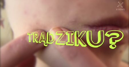 Te produkty pomogą pozbyć się trądziku