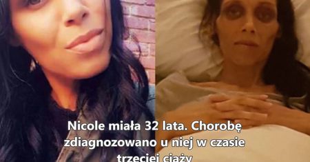 Hictoria walki z rakiem wątroby - Nicole Yarran