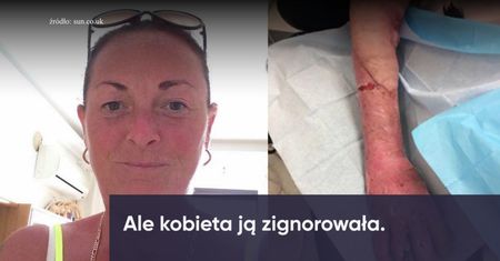 Mała rana na łokciu przyczyniła się do sepsy