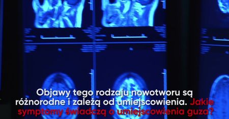 Jakie są objawy guza mózgu?