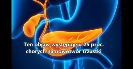 Pierwsze objawy raka trzustki