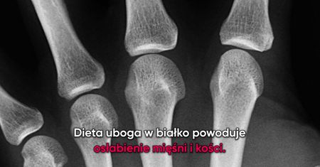 Objawy niedoboru białka w organizmie