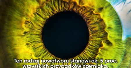 Kobieta w ciąży straciła oko. Zaatakował ją nowotwór