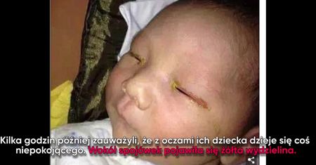 Rodzice ostrzegają – nie rób dziecku zdjęć z użyciem lampy błyskowej!