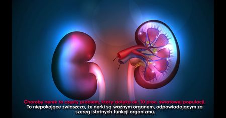 Najlepsze produkty, z których powinna składać się dieta osób chorujących na nerki