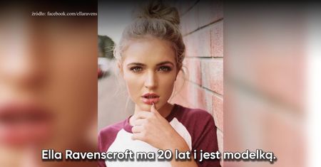 Modelka przestrzega przed rakiem skóry po tym, jak wykryto u niej potencjalne zmiany nowotworowe