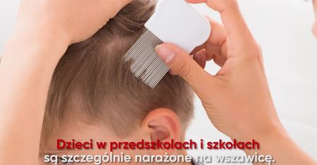 Sprawdzone domowe sposoby na skuteczne usuwanie wszy