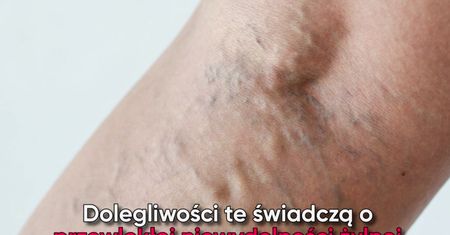 Objawy chorego serca widoczne na skórze