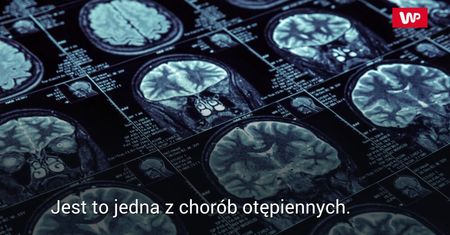 Sposoby na obniżenie ryzyka alzheimera