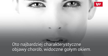 Co twarz mówi o twoim zdrowiu?